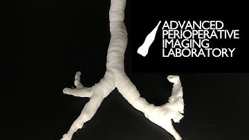 3D Printed Bronchoscopy Simulator -- Part 3: AIRWAY 3D PRINTING [SLIC3R & TAZ 5]