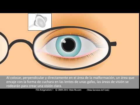 Video: ¿Cómo las lentes cilíndricas corrigen el astigmatismo?