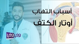 أسباب التهاب أوتار الكتف وطرق علاجها