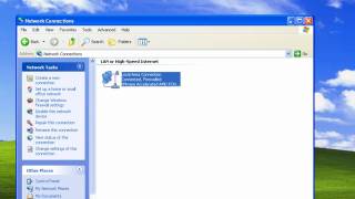 Windows XP - Bacis TCP\/IP Settings