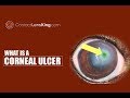 Corneal Ulcer Causes, Symptoms, Treatments