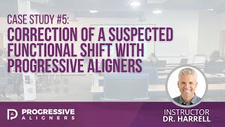 Case Study #5: Correction of a Suspected Functional Shift with Progressive Aligners | Dr. Harrell