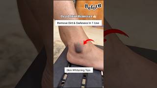 Dark Feet Remover Clean All Dirt & Tanning