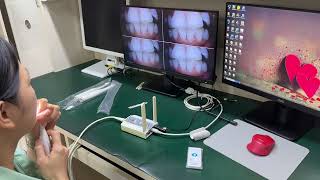 Wireless Intraoral Camera & Dental Monitor System Demonstration | Enteno Technology