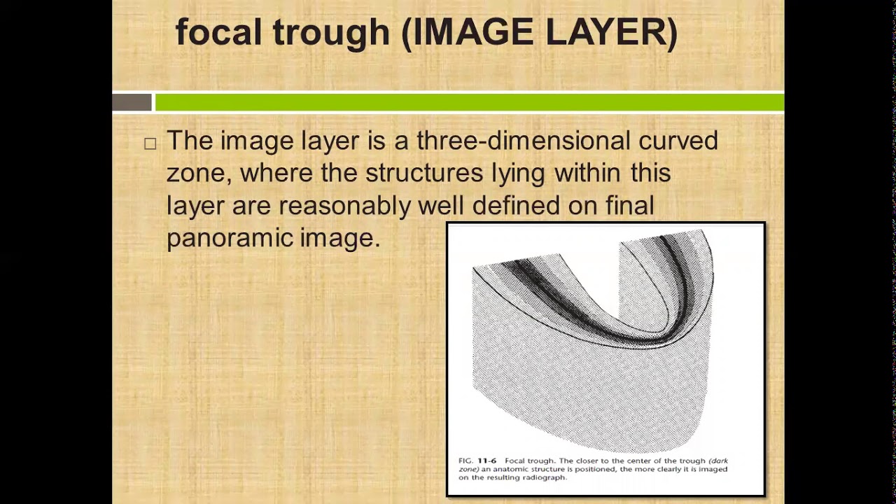 Panoramic Radiography YouTube Panoramic Radiography YouTube