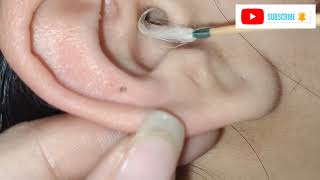 ASMR Cranial Nerve Exam & Ear Cleaning (Earwax Removal) Soft Spoken