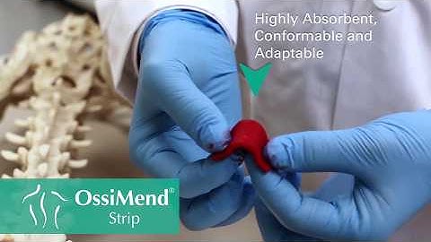 Collagen Matrix - Orthopaedic OssiMend® Strips & Pads - Product Demo