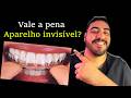 Se você pensa em usar ALINHADOR INVISIVEL, assista esse vídeo!