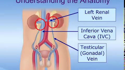 How do varicoceles cause male infertility | Dr. Vasan S S | Varicocele Causes | Manipal Hospitals