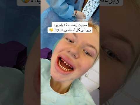 سويت إبتسامة هولييوود وبردلي كل أسناني
