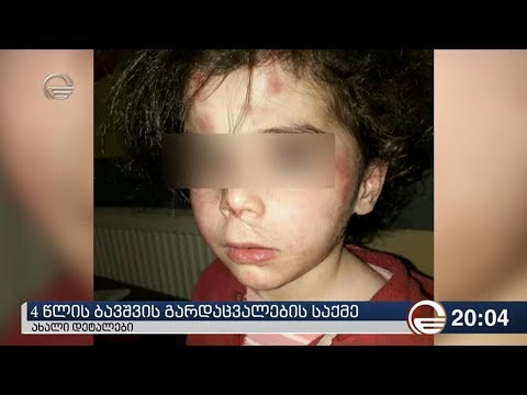 4 წლის ბავშვის გარდაცვალების საქმე