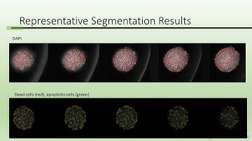 Case for 3D Cell Culture Models in Drug Discovery