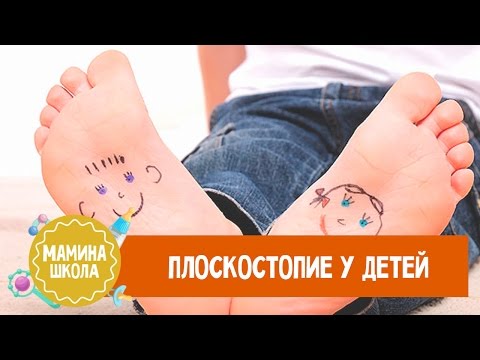 Лечение плоскостопия у детей 7 лет в домашних условиях