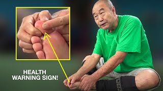 Chinese Master: 'Your Big Toe Tells a lot About Your Health'