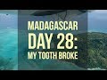 Madagascar Day 28: My tooth broke