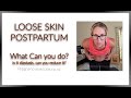 Loose Skin Postpartum, Can we reduce it?