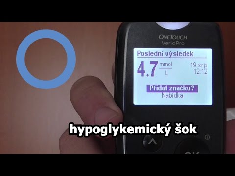 Video: Ranná Fulminantná Nefropatia Spojená S Polyomavírusom BK U Dvoch Pacientov Po Transplantácii Obličky S Nízkym Titrom Neutralizačných Protilátok, Ktorí Dostávajú Aloštepy Od Toho Is