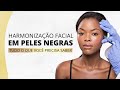 Harmonização Facial em peles negras - tudo o que você precisa saber