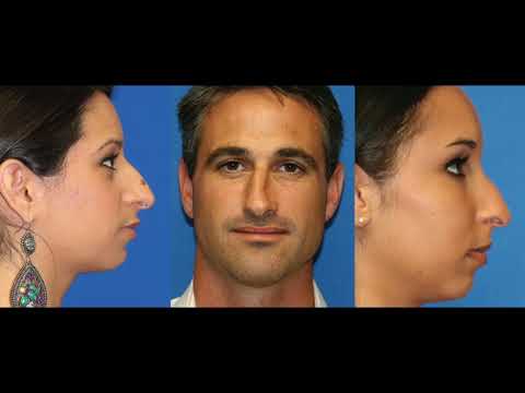 Video thumbnail: The Functional Nose by Dr. Amir Karam, Rhinoplasty Specialist in San Diego — DrAmirKaram