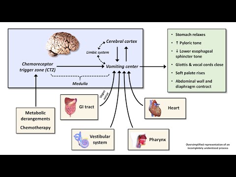 An Approach to Acute Nausea and Vomiting