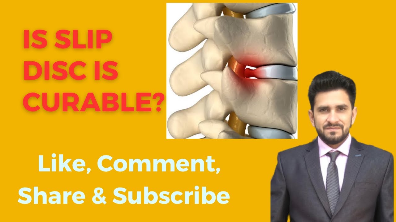 Is Slip Disc/ Disc Bulge Curable? What is Slip Disc? स्लिप डिस्क क्या है ? YouTube