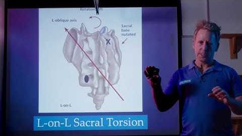 Wervelkolom- en bekkenbeweging - Fryettes wetten van de wervelkolommechanica