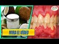 CURA LAS CARIES, ENFERMEDADES DE LAS ENCÍAS Y BLANQUEA LOS DIENTES CON ESTA PASTA DE DIENTES NATURAL