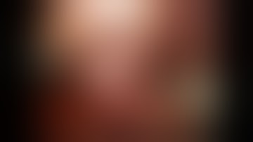 Robotic cholecystectomy with ICG Cholangiography