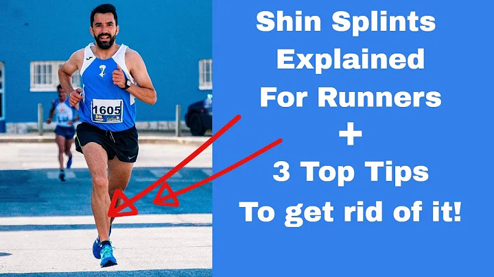 Shin Splints Explained for Runners + 3 Top Tips