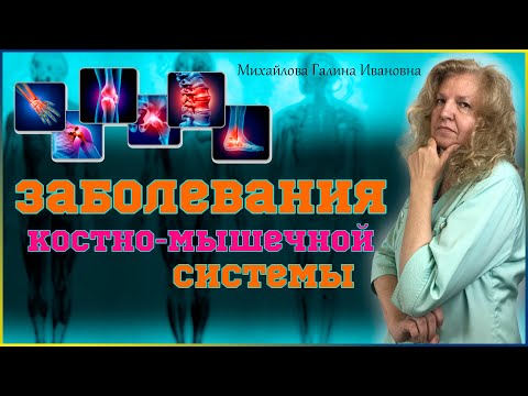 ЗАБОЛЕВАНИЯ КОСТНО-МЫШЕЧНОЙ СИСТЕМЫ и МЕТОДИКА ЛЕЧЕНИЯ | КИЕВСКИЙ ЦЕНТР ФУНГОТЕРАПИИ