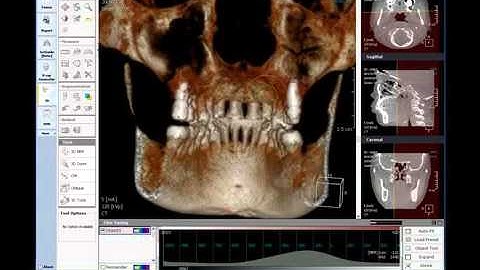 3D Module: 3D Task tool/ MPR/ CPR/ Zoom | CYBERMED