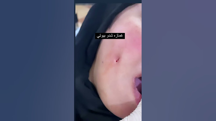 عمل غمازه