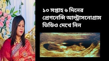 ১০ সপ্তাহ ৬ দিনের প্রেগনেন্সি আল্ট্রাসনোগ্রাম ভিডিও দেখে নিন