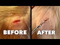 AWESOME HEAD STAPLE REMOVAL!! (With Super Cute Kiddo) | Dr. Paul