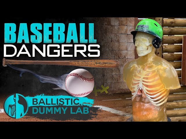 Dangers of Baseball - 150MPH Baseball To The Chest 