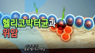 헬리코박터균과 위암 - 코로나19 시대, 당신의 위가 위험하다! (KBS_752회_2020.11.11 방송)