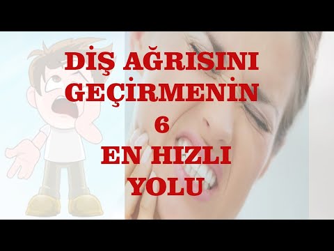 Diş Ağrısından Hemen Kurtul / Rahatlatıcı Yöntemler Nelerdir?