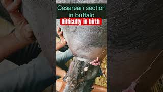 Difficulty in birth l Dystocia l Cesarean section l Dr Umar Khan