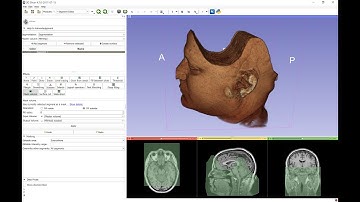 New "Surface cut" and "Mask volume" tools for 3D Slicer segment editor