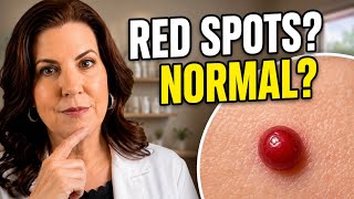 Red Spots on Your Skin? Here's What You Need to Know