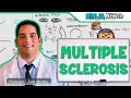 Multiple Sclerosis | Etiology, Pathophysiology, Types of MS, Clinical Features, Diagnosis, Treatment