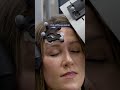 What is TMS therapy? Depression treatment explained