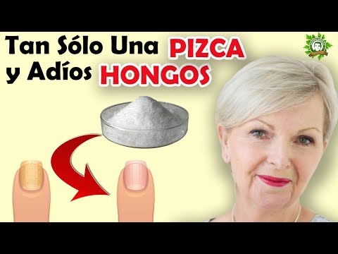 Como eliminar los hongos en la piel