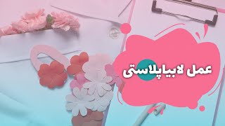 ️عمل لابیاپلاستی 