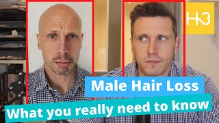 Is male hair loss inevitable?