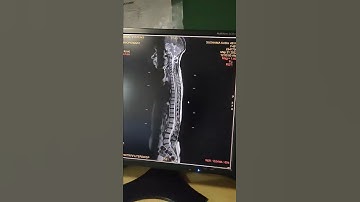 how to pasted & Film... ADW #hospital #ctscan #radiology