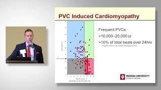 Michael Emery, MD, Premature Ventricular Contractions  When to be Concerned and Which Tests to Evalu