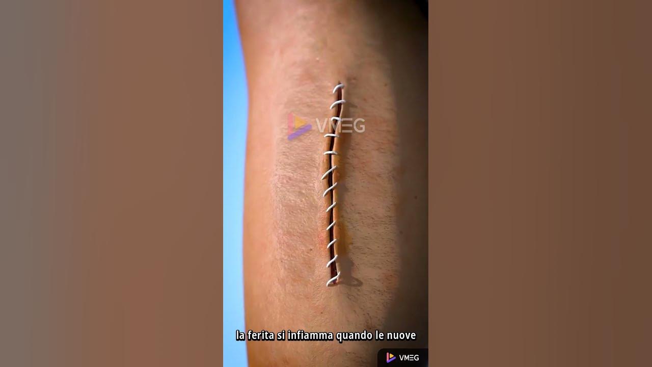 Quando Si Mettono I Due Punti Come ti mettono i punti 😝 - YouTube