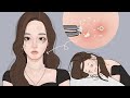 시각적 팅글 ASMR! 화장으로 막혀버린 모공 청소! 딥 클렌징 여드름 케어, 여드름 압출 / LULUPANG