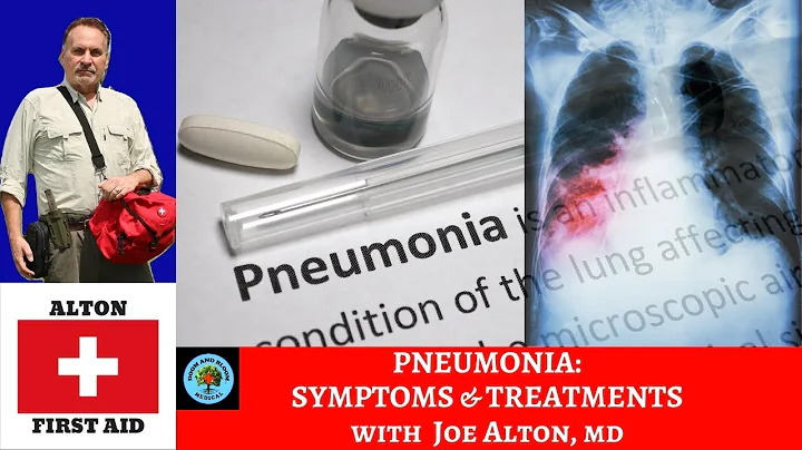 Pneumonia: Symptoms, Treatment & more With Dr. Alton